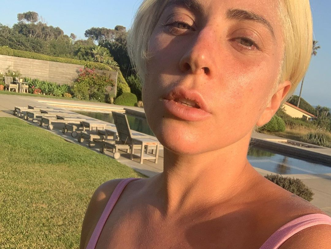 Image credit: Instagram | @ladygaga
